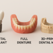Advances in Tooth Replacement Options