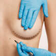 Holistic Strategies for Preparing Your Body and Mind for Breast Surgery